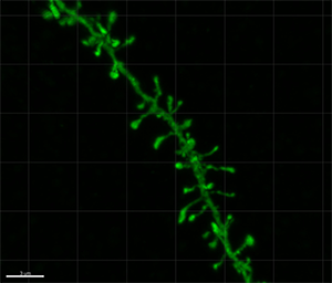 3D Dendritic Spine Analysis using Deep Learning